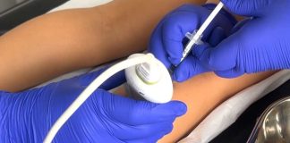 Hospital Roberto del Río utiliza bótox para transformar la movilidad de niños con parálisis cerebral